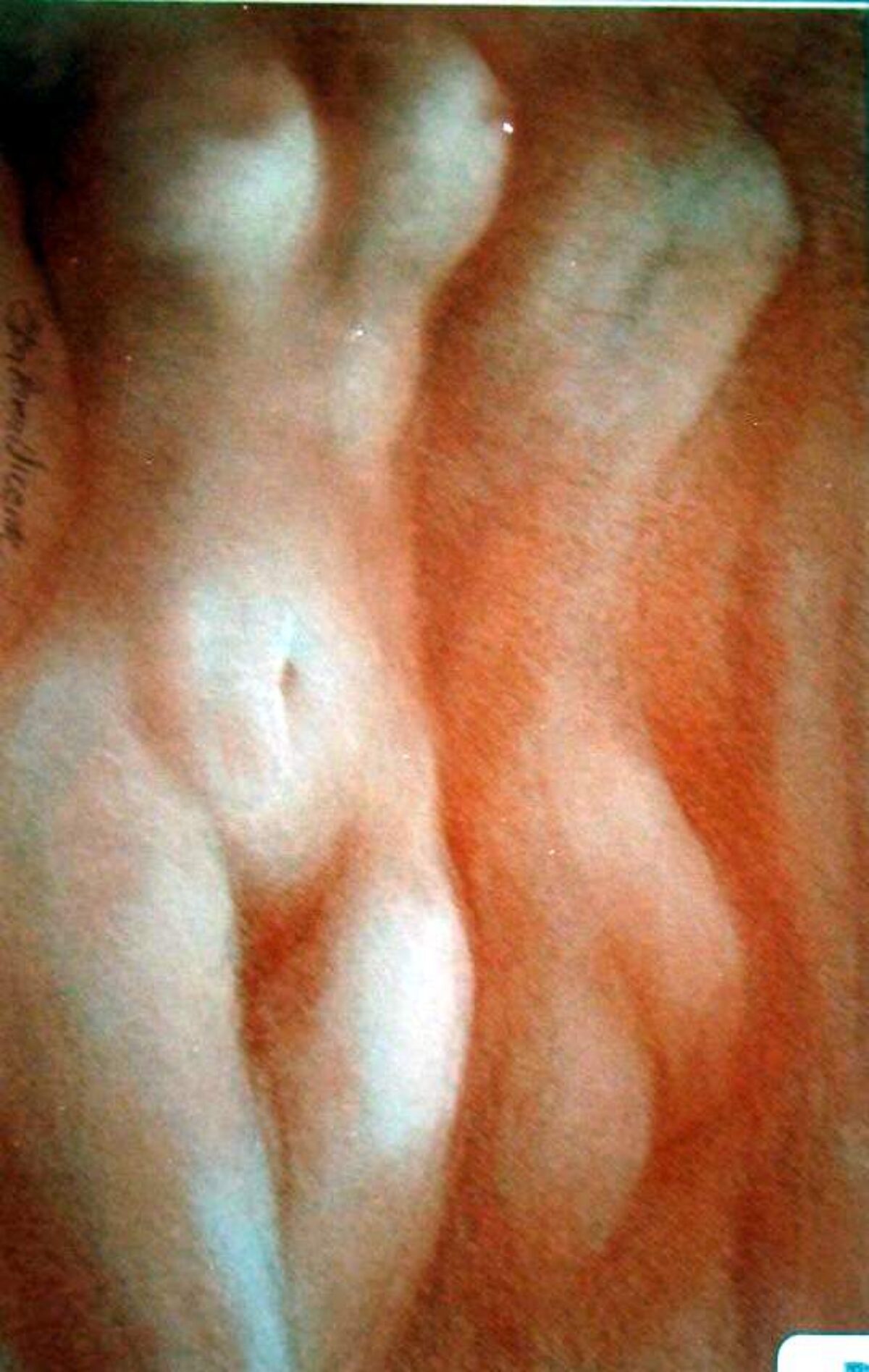 Paisaje desnudo